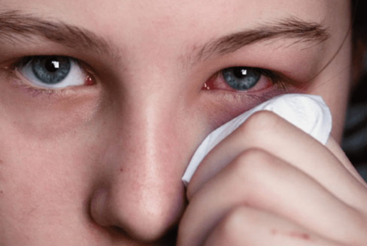Лікування запалення очей в Херсоні: причини хвороб і методи боротьби з ними